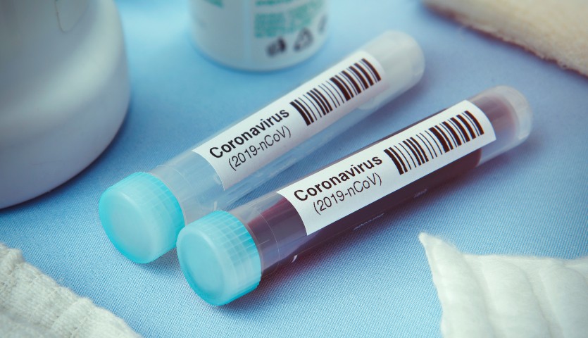 Los laboratorios farmacéuticos aceleran en la carrera contra el  coronavirus: ya hay 20 vacunas en desarrollo - FEIQUE - Federación  Empresarial de la Industria Química Española